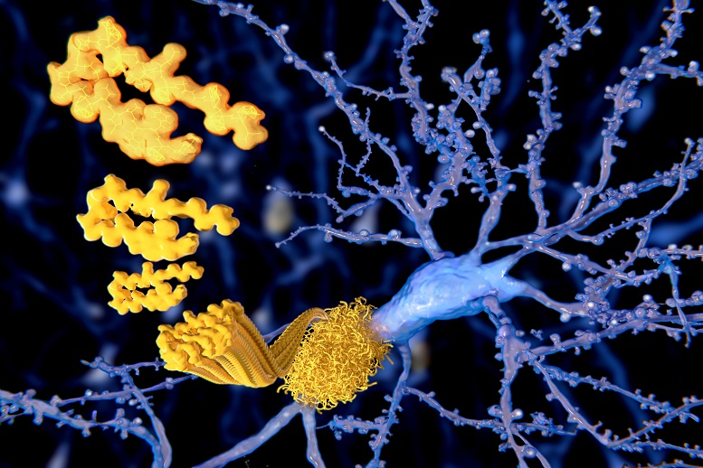 FDA Approves Biogen’s (NASDAQ:BIIB) New Alzheimer Drug